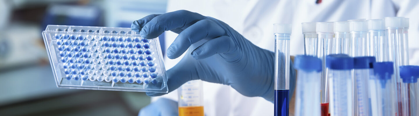 Arzt arbeitet mit einer Mikrotiterplatte für eine Infektions-Analyse