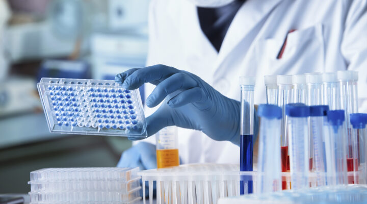 Arzt arbeitet mit einer Mikrotiterplatte für eine Infektions-Analyse